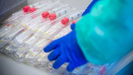 Im Kreis sind insgesamt 28 Menschen im Zusammenhang mit dem Coronavirus verstorben. 