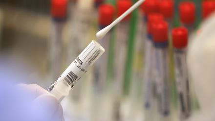 Die Zahl der Todesfälle im Zusammnehang mit dem Coronavirus ist im Kreis auf 36 angestiegen.