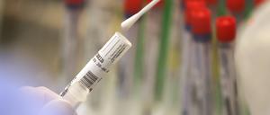 Die Zahl der Todesfälle im Zusammnehang mit dem Coronavirus ist im Kreis auf 36 angestiegen.