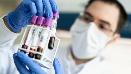 Die Zahl der Coronafälle stieg im Kreis auf 469 an. Insgesamt sind bislang 38 Personen im Zusammenhang mit dem Coronavirus verstorben.
