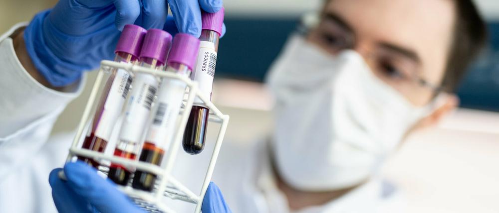 Die Zahl der Coronafälle stieg im Kreis auf 469 an. Insgesamt sind bislang 38 Personen im Zusammenhang mit dem Coronavirus verstorben.