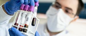 Die Zahl der Coronafälle stieg im Kreis auf 469 an. Insgesamt sind bislang 38 Personen im Zusammenhang mit dem Coronavirus verstorben.