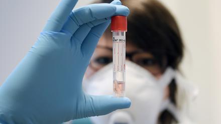 Die Zahlen steigen im Kreis wieder leicht an. Insgesamt sind bisher 38 Menschen im Zusammenhang mit dem Coronavirus gestorben.