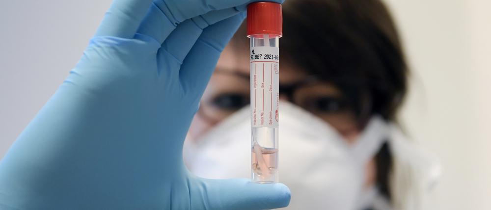 Die Zahlen steigen im Kreis wieder leicht an. Insgesamt sind bisher 38 Menschen im Zusammenhang mit dem Coronavirus gestorben. 