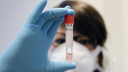 Die Zahlen der positiv auf Corona getesteten Mittelmärker geht zurück.