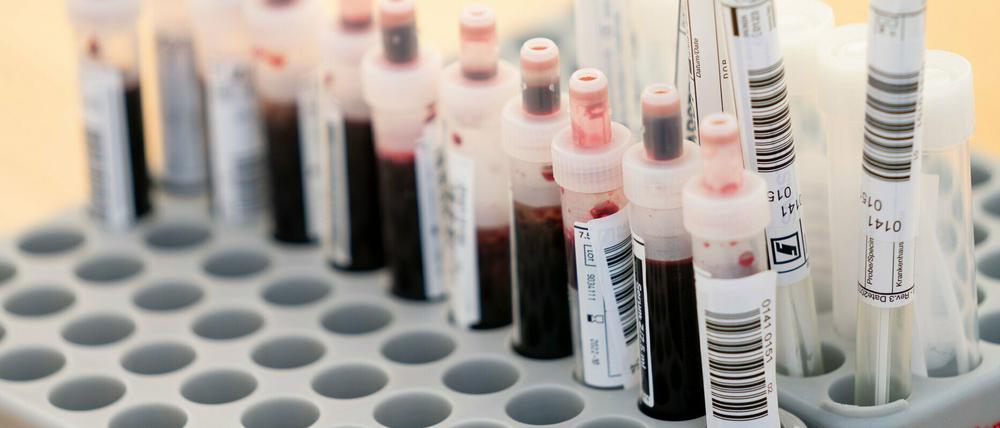 Entnommene Abstrichtests und Blutproben.