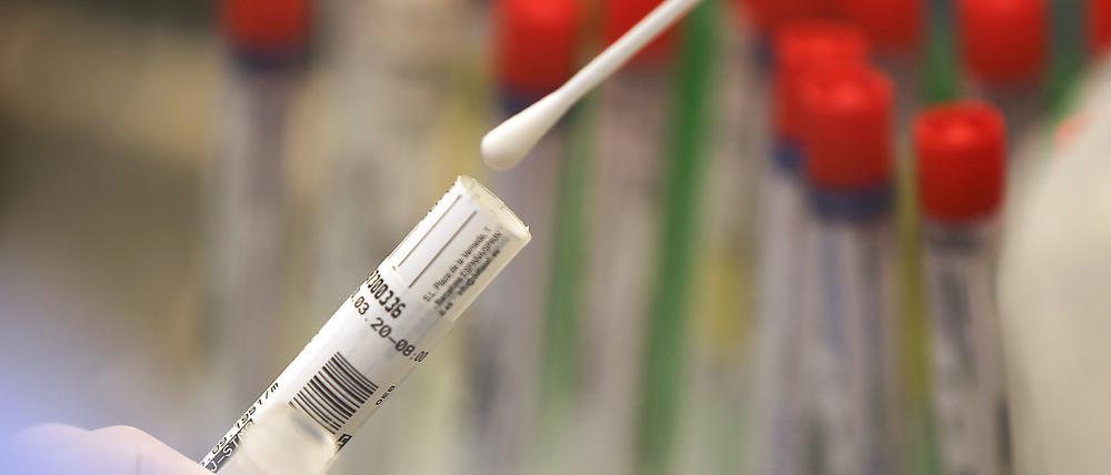 Die Zahl der Verdachtsfälle im Kreis ist seit Montag von 2503 auf 2638 Personen angestiegen.