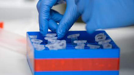 Aktuell meldet der Kreis Potsdam-Mittelmark 500 Personen die positiv auf das Coronavirus getestet wurden.