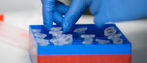 Aktuell meldet der Kreis Potsdam-Mittelmark 500 Personen die positiv auf das Coronavirus getestet wurden.