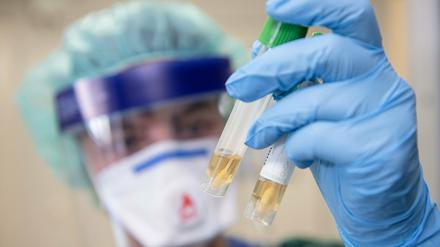 In Potsdam-Mittelmark sind aktuell 521 Menschen mit dem Coronavirus infiziert.