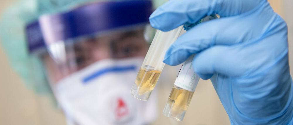 In Potsdam-Mittelmark sind aktuell 521 Menschen mit dem Coronavirus infiziert.