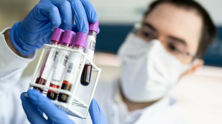 Die Zahl der Infizierten in Potsdam-Mittelmark hat sich auf insgesamt 521 erhöht.