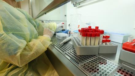 Covid-19-Antikörpertests im Klinikum Ernst-von-Bergmann.