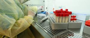 Covid-19-Antikörpertests im Klinikum Ernst-von-Bergmann.
