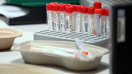 In Potsdam-Mittelmark sind jetzt insgesamt 548 Menschen infiziert. (Symbolbild)