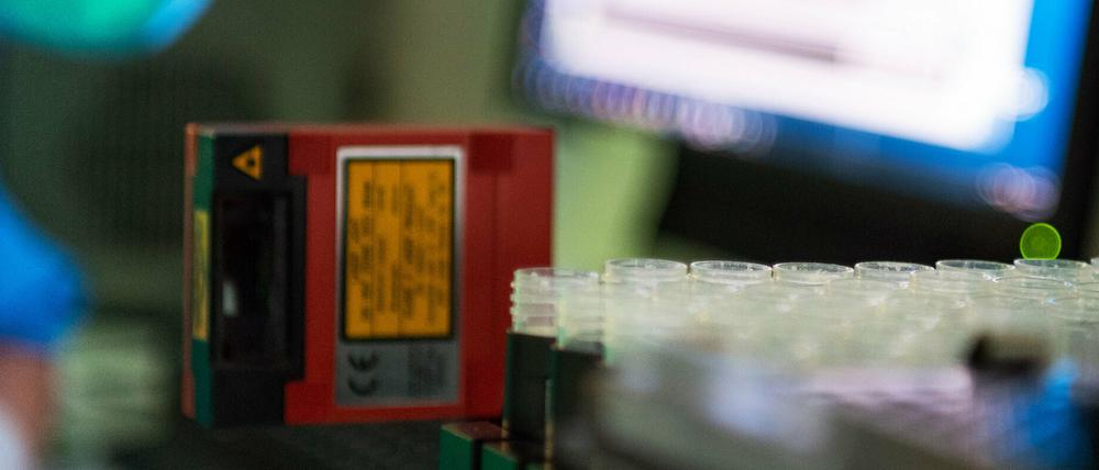 Laborbild aus dem Potsdamer Ernst-von-Bergmann-Klinikum.