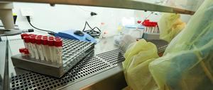 Der Wert an Neuinfektionen innerhalb einer Woche liegt in Potsdam-Mittelmark aktuell bei eins. (Symbolbild) 