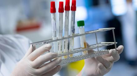 Covid-19-Neuinfektionen gab es im Landkreis Mittelmark am Sonntag nicht.