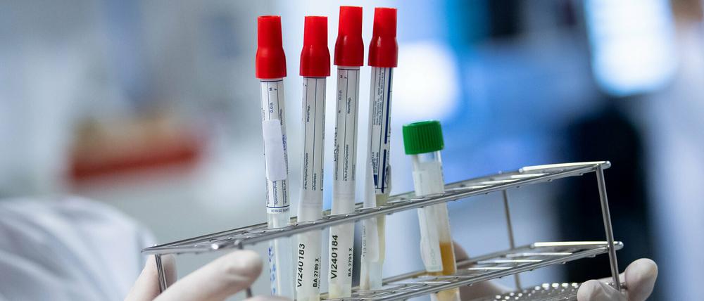 Covid-19-Neuinfektionen gab es im Landkreis Mittelmark am Sonntag nicht. 