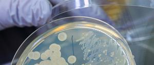 Eine Laborprobe mit E. coli-Bakterien.