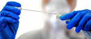 Auch der Umgang mit Testergebnissen sorgt in Potsdam für einen juristischen Streit (Symbolbild).