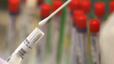 In Brandenburg kamen im Zusammenhang mit dem Coronavirus bisher 174 Menschen ums Leben.