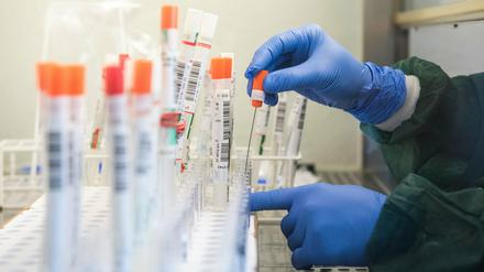 In Brandenburg sind seit Beginn der Pandemie 261 Menschen im Zusammenhang mit dem Coronavirus gestorben.