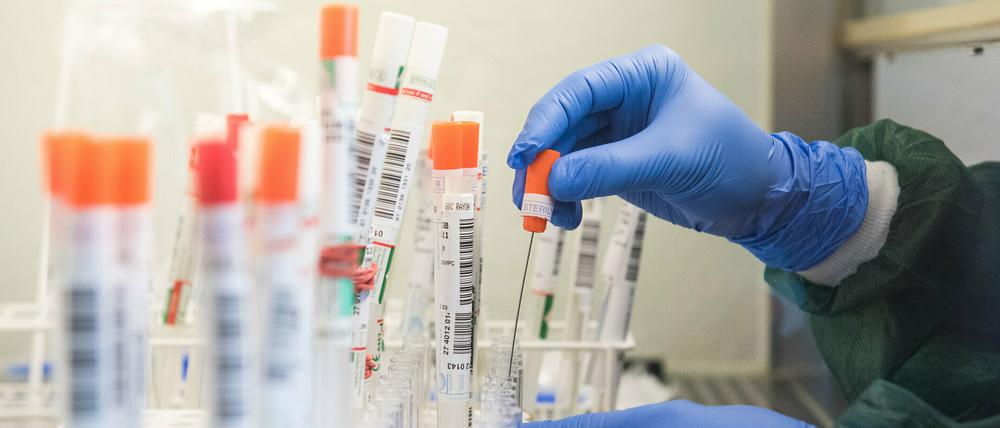 In Brandenburg sind seit Beginn der Pandemie 261 Menschen im Zusammenhang mit dem Coronavirus gestorben.