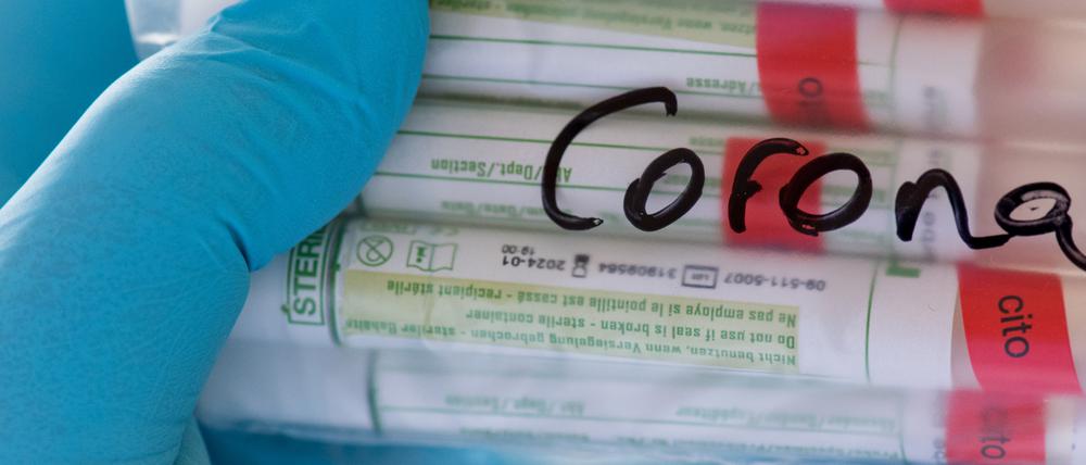 Das Corona-Niveau schwächt sich nicht ab (Symbolbild).