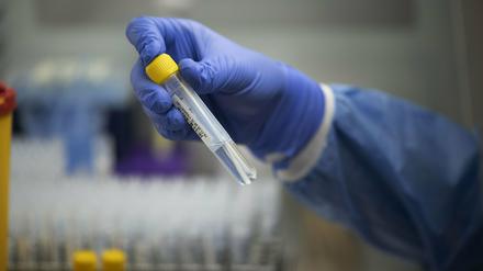 In Brandenburg sind aktuell 5924 Menschen akut an Covid-19 erkrankt (Symbolbild).