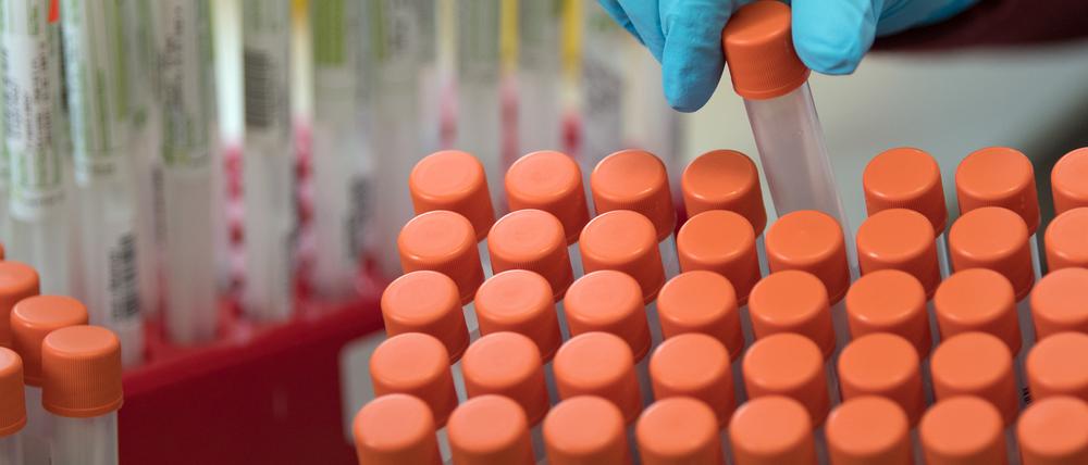 In Potsdam-Mittelmark sind bislang 62 Menschen im Zusammenhang mit dem Coronavirus gestorben (Symbolbild).