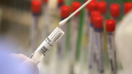 Erneut hat der Landkreis drei Todesfälle im Zusammenhang mit dem Coronavirus zu beklagen (Symbolbild).