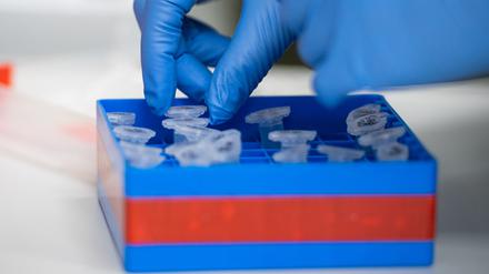 Bislang sind 131 Menschen in Potsdam-Mittelmark im Zusammenhang mit dem Coronavirus gestorben (Symbolbild).