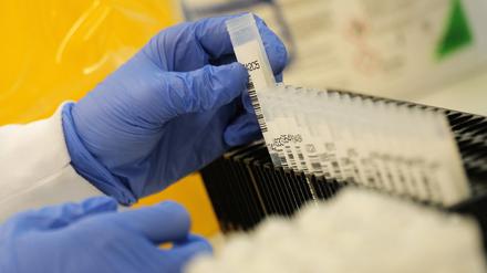 Die Virus-Variante B117 trat zuerst in Großbritannien auf, jetzt ist sie in der Mittelmark angekommen. 