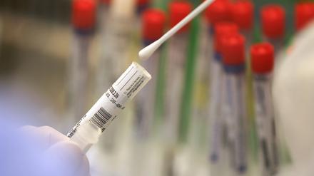 Im Landkreis ist ist eine weitere Infektion mit der südafrikanischen Coronavirus-Variante B1351 gemeldet worden (Symbolbild).