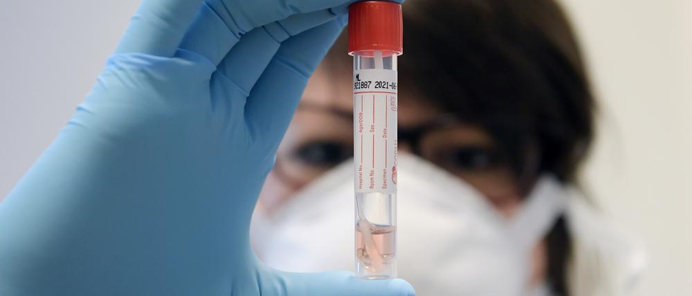 In Potsdam-Mittelmark liegt die Sieben-Tage-Inzidenz jetzt unter 50 (Symbolbild).