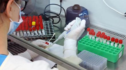 Im Bergmann-Klinikum wurden 24 Fälle der britischen Mutation B.1.1.7 festgestellt.