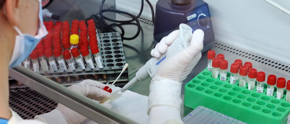 Im Bergmann-Klinikum wurden 24 Fälle der britischen Mutation B.1.1.7 festgestellt.