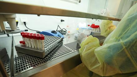 Der Bergmann-Klinikum testet Proben bislang nur mit PCR auf der Coronavirus und mit Target-PCR auf Virusvarianten. Bald sollen auch Sequenzierungen möglich sein.