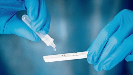 Kostenlose Schnelltest will die Stadt Potsdam ab dem 1. März anbieten.