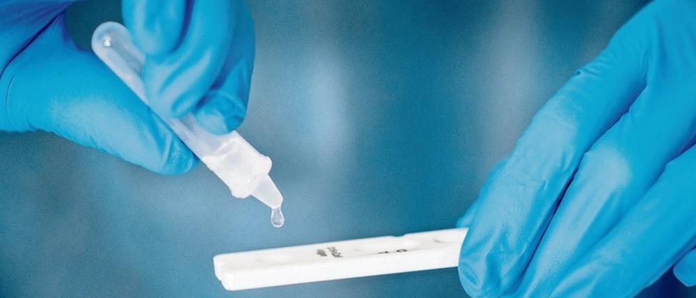 Kostenlose Schnelltest will die Stadt Potsdam ab dem 1. März anbieten.
