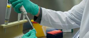 PCR-Test für die Analyse auf Mutationen des Coronavirus (Symbolbild)