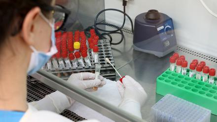 Vorbereitung eines PCR-Tests zur Analyse. (Symbolbild)