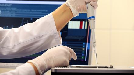 Sequenzierungen im Labor des Klinikum Ernst von Bergmann