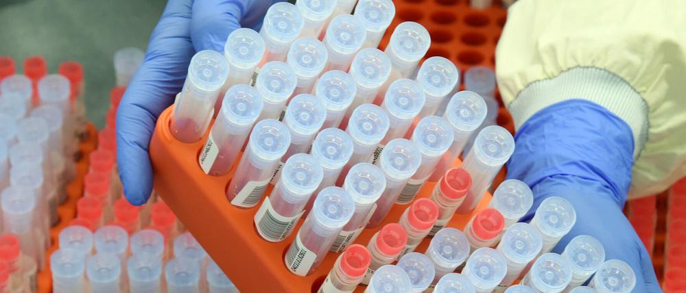 Die infizierten Personen aus Potsdam befinden sich in Quarantäne (Symbolbild).