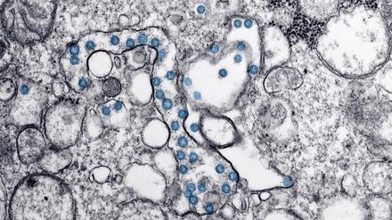 Sars-CoV-2-Viren (blau) sehen im Transmissionselektronenmikroskop heute noch so aus wie beim ersten Covid-19-Patienten in den USA. Doch das Erbgut der Erreger im Inneren der Virushülle verändert sich stetig. 
