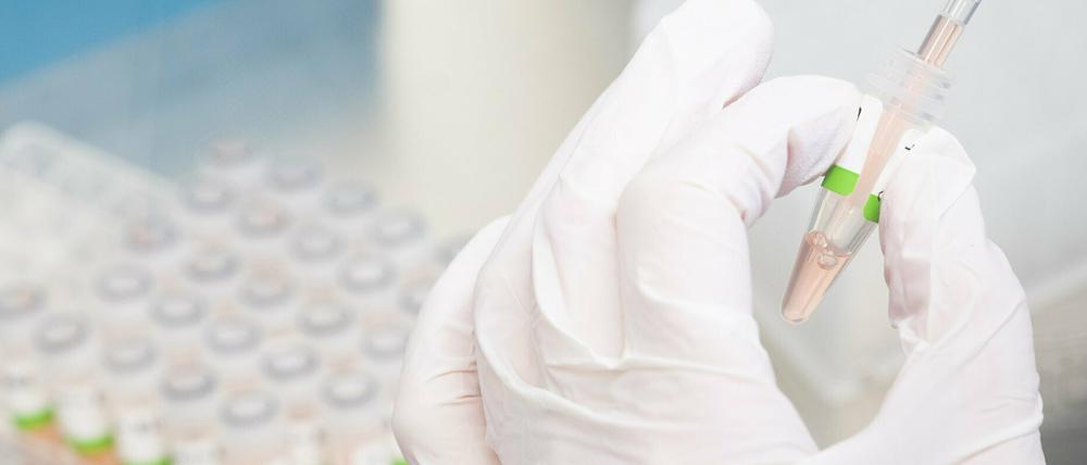 In einem Labor wird ein PCR-Test vorbereitet.