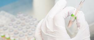In einem Labor wird ein PCR-Test vorbereitet.