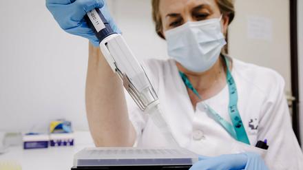 Ein PCR-Tests zur Erkennung des Affenpockenvirus.