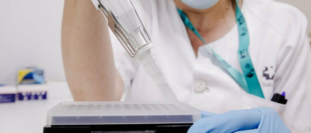 Ein PCR-Tests zur Erkennung des Affenpockenvirus.